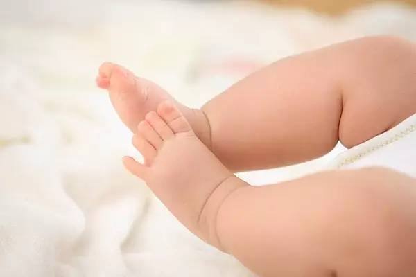 新生婴儿正常大便图解