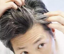 男人怎么正确预防白发