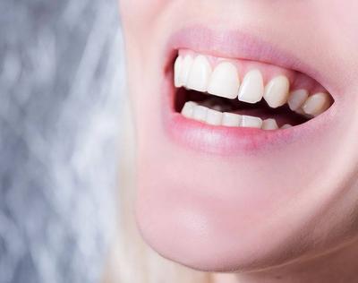 牙齿上的黄垢怎么去除 去除牙齿