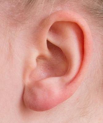 耳垂有硬东西摁它会痛如何治疗呢