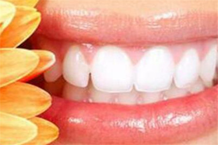 经常牙龈出血的四个常见原因