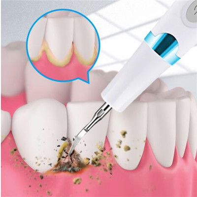 牙黄变白最实用的方法
